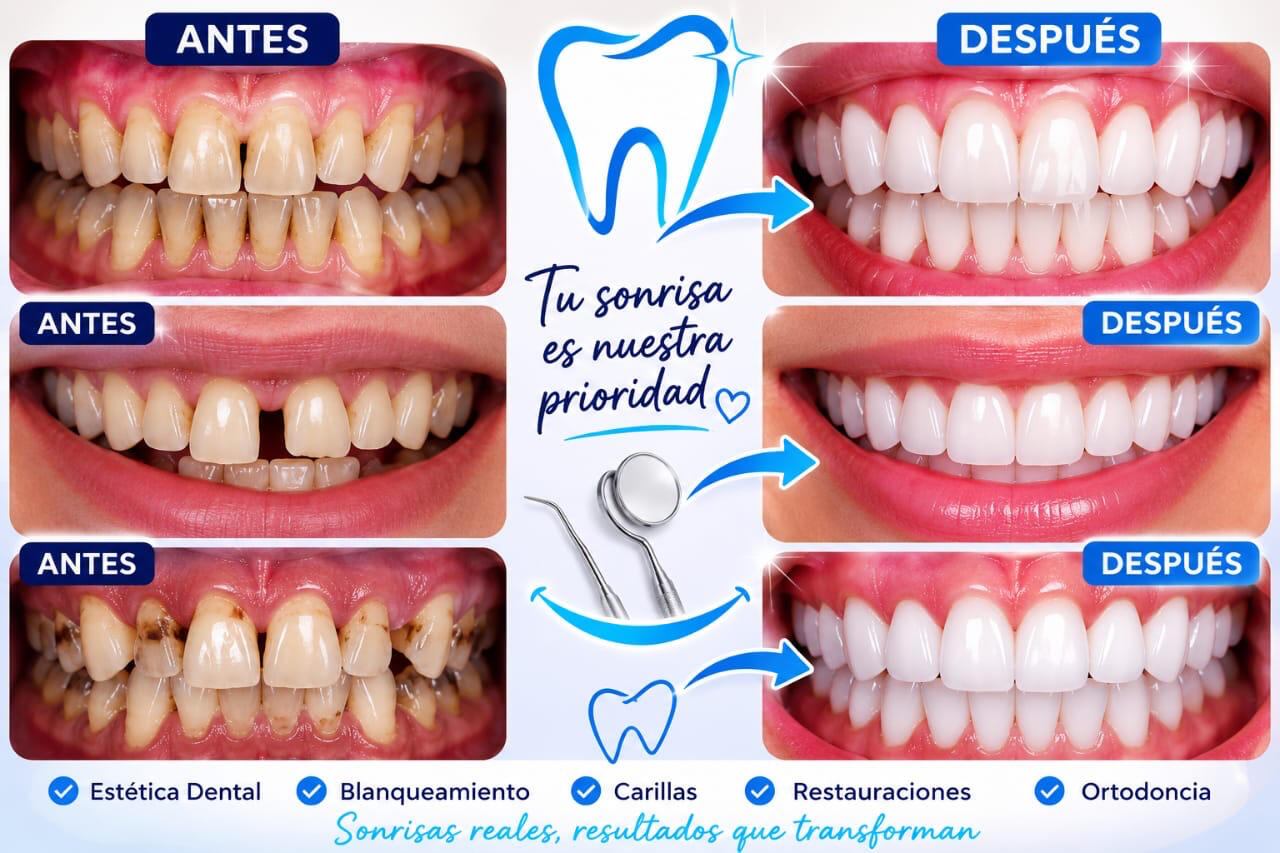 Resultados dentales antes y después